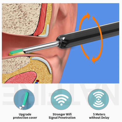 SonoScope™ Smart Ear Cleaner